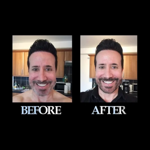 Blackbeard for men black before and after 4 Blackbeard for men black before and after 4