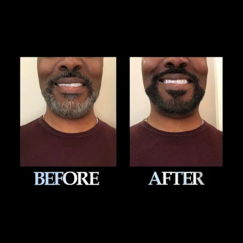 Blackbeard for men brownblack before and after 6 Blackbeard for men brownblack before and after 6