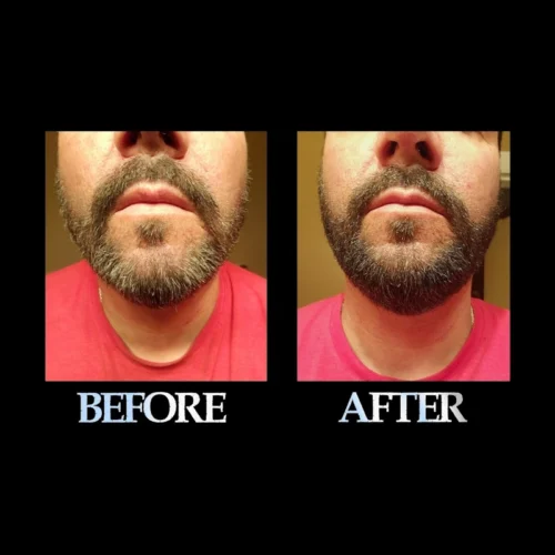 Blackbeard for men dark brown before and after 2 Blackbeard for men dark brown before and after 2