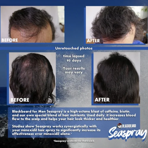 Seaspray before and after Blackbeard for men Seaspray before and after